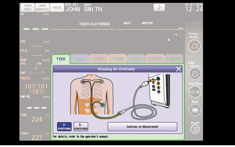 SVM-7600 Vận hành thân thiện với người dùng