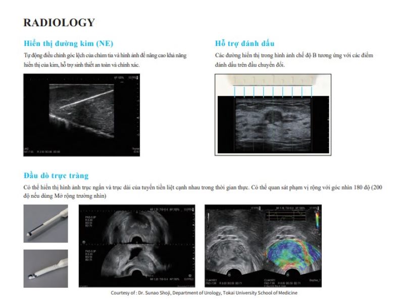Máy siêu âm Arietta 65 được ứng dụng trong Radiology