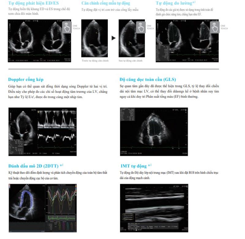 Máy siêu âm Arietta 65 ứng dụng trong tim mạch