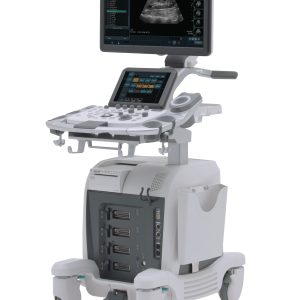 Máy siêu âm Arietta 65 - Giải pháp siêu âm toàn diện cho chẩn đoán lâm sàng
