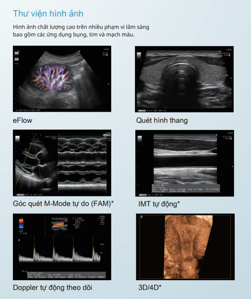 Máy siêu âm Arietta cho hình ảnh sắc nét