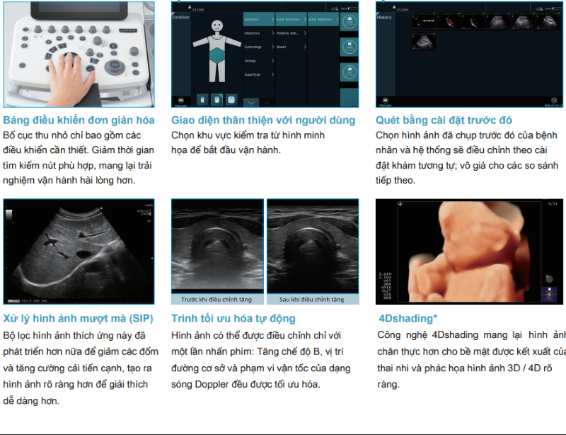 Arietta với nhiều tính năng vượt trội